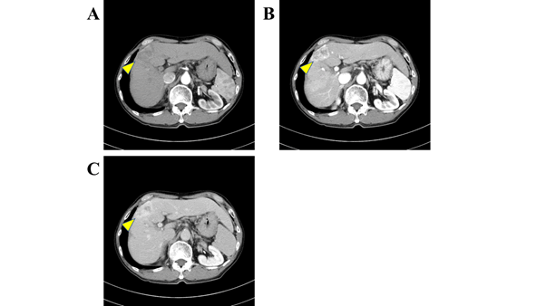 Research Journal of Oncology-Dynamic